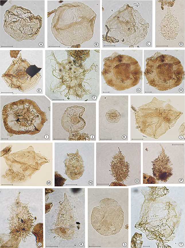 Fig. 12 Selected biostratigraphically significant dinoflagellate cysts and acritarchs from the Rødryggen-1 core. Scale bars: 25 µm. A, B and C: Lagenorhytis delicatula, showing variable morphology, sample 54.31 m, slide 7. D: Gochteodinia villosa subsp. villosa, sample 56.88 m, slide 4 and 5. E: Leptodinium subtile, sample 90.27 m, slide 5. F: Perisseiasphaeridium insolitum, sample 59.85 m, slide 4. G, H and I: large Pterospermella spp., sample 40.62 m, slide 5, and sample 35.2 m, slide 7. J and K: small Pterospermella spp., sample 43.43 m, slide 5 and sample 35.2, slide 7. L and M: Isthmocystis distincta, sample 35.02 m, slide 3. N, O, P, Q and R: morphological variations of Gochteodinia villosa subsp. villosa, (N–Q) sample 37.71 m, slide 7, and (R) sample 35.02 m, slide 4. S: Circulodinium compta, sample 31.95 m, slide 4. T: Scriniodinium pharo, sample 24.1 m, slide 3.