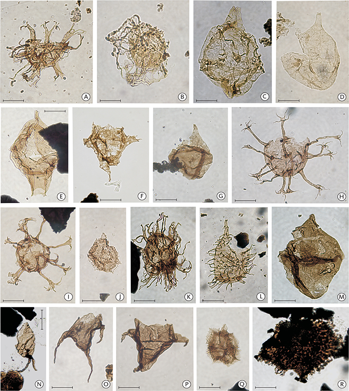 Fig. 13 Selected biostratigraphically significant dinoflagellate cysts and acritarchs from the Rødryggen-1 (A–M) and the Brorson Halvø-1 (N–R) cores. Scale bars: 25 µm. A: Palaecysta palmula, sample 24.1 m, slide 2. B: Rotosphaeropsis thule, sample 27.0 m, slide 7. C: Scriniodinium pharo, sample 27.1 m, slide 3. D: Paragonyaulacysta borealis, sample 35.2 m, slide 4. E: Tubotuberella apatela, sample 25.0 m, slide 9. F: Phoberocysta neocomica, sample 13.2 m, slide 2. G: Paragonyaulacysta capillosa, sample 21.38 m, slide 2. H: Oligosphaeridium complex, sample 10.17 m, slide 2. I: Oligosphaeridium complex, sample 17.82 m, slide 2. J: Nelchinopsis kostromiensis, sample 10.17 m, slide 2. K: Palaecysta palmula, sample 9.00 m, slide 2. L: Gochteodinia villosa subsp. villosa, sample 24.1 m, slide 3. M: Lagenorhytis delicatula, sample 2.78 m, slide 4. N: Batioladinium longicornutum, sample 3.37 m, slide 3. O: Muderongia tetracantha, sample 9.18 m, slide 3. P: Muderongia staurota, sample 9.18 m, slide 3. Q: Nelchinopsis kostromiensis, sample 6.16 m, slide 3. R: Pseudoceratium anaphrissum, sample 3.37 m, slide 3.