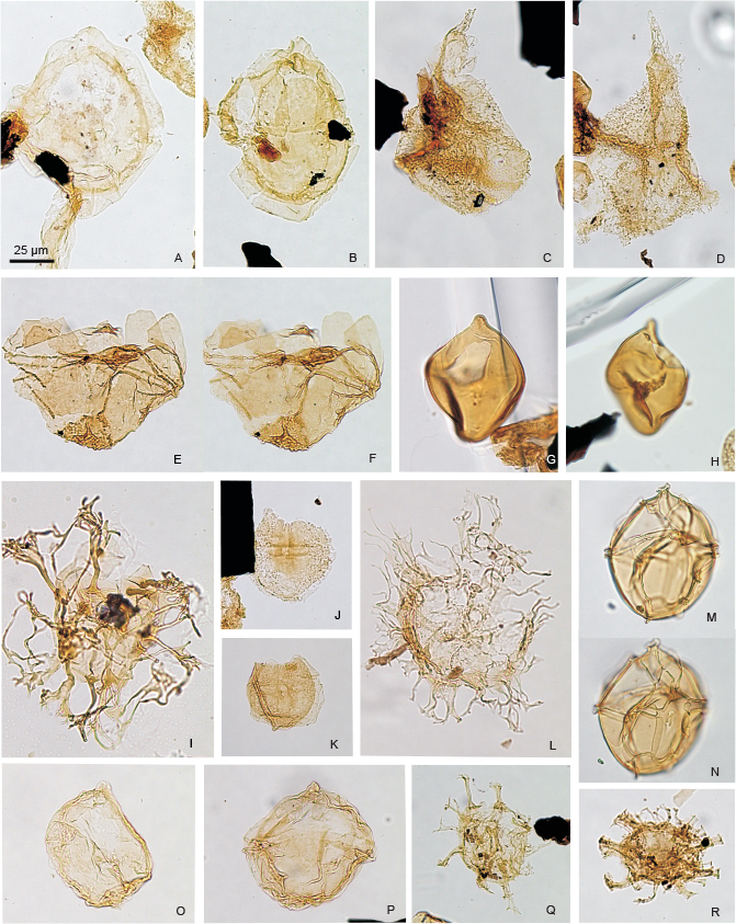 Fig. 6 Stratigraphically significant dinoflagellate cysts from the middle to upper Oxfordian S. crystallinum Zone in Milne Land, from locality 39, east of Visdal, and localities 2 (Kosmoceras Dal), 3 (Nordøstelv) and 4 (‘Hystrix’ Dal), eastern Milne Land (locations in Fig. 1). The illustrated specimens are referred to locality numbers, GGU sample number, slide number and England Finder coordinates. The illustrated specimens are marked with a red circle on the original slides. Magnification is x400 as indicated by a 25 µm scalebar in panel A that applies to all figures. A: Scriniodinium crystallinum, locality 39, sample GGU234229, slide 7, E.F. U35/2. B: Scriniodinium crystallinum, locality 39, sample GGU234229, slide 7, E.F. P25/2. C: Trichodinium scarburghense, locality 2, sample GGU234235, slide 4, E.F. K29/4. D: Trichodinium scarburghense, locality 2, sample GGU234235, slide 4, T34/3. E, F: Atopodinium haromense, high and low focus, locality 3, sample GGU234242, slide 8, P49/2. G: Chytroeisphaeridia cerastes, locality 2, sample GGU234155, slide 7, E.F. J26. H: Chytroeisphaeridia cerastes, locality 2, sample GGU234155, slide 7, E.F. K52/3. I: Rigaudella aemula, locality 2, sample GGU234240, slide 6, E.F. H51. J: Ambonosphaera staffinensis, locality 39, sample GGU234227, slide 7, E.F. O26. K: Ambonosphaera staffinensis, locality 39, sample GGU234223, slide 7, E.F. U53/2. L: Systematophora valensii, locality 39, sample GGU234230, slide 3, E.F. U48/1. M, N: Leptodinium subtile, high and low focus, locality 39, sample GGU234219, slide 3, P53/2. O: Scriniodinium inritibile, locality 39, sample GGU 234230, slide 7, E.F. R51. P: Scriniodinium inritibile, locality 39, sample GGU234220, slide 7, E.F. N28/1. Q: Compositosphaeridium polonicum, locality 4, sample GGU234159, slide 8, E.F. K36/3. R: Compositosphaeridium polonicum, locality 2, sample GGU234239, slide 4, E.F. H46/m4.