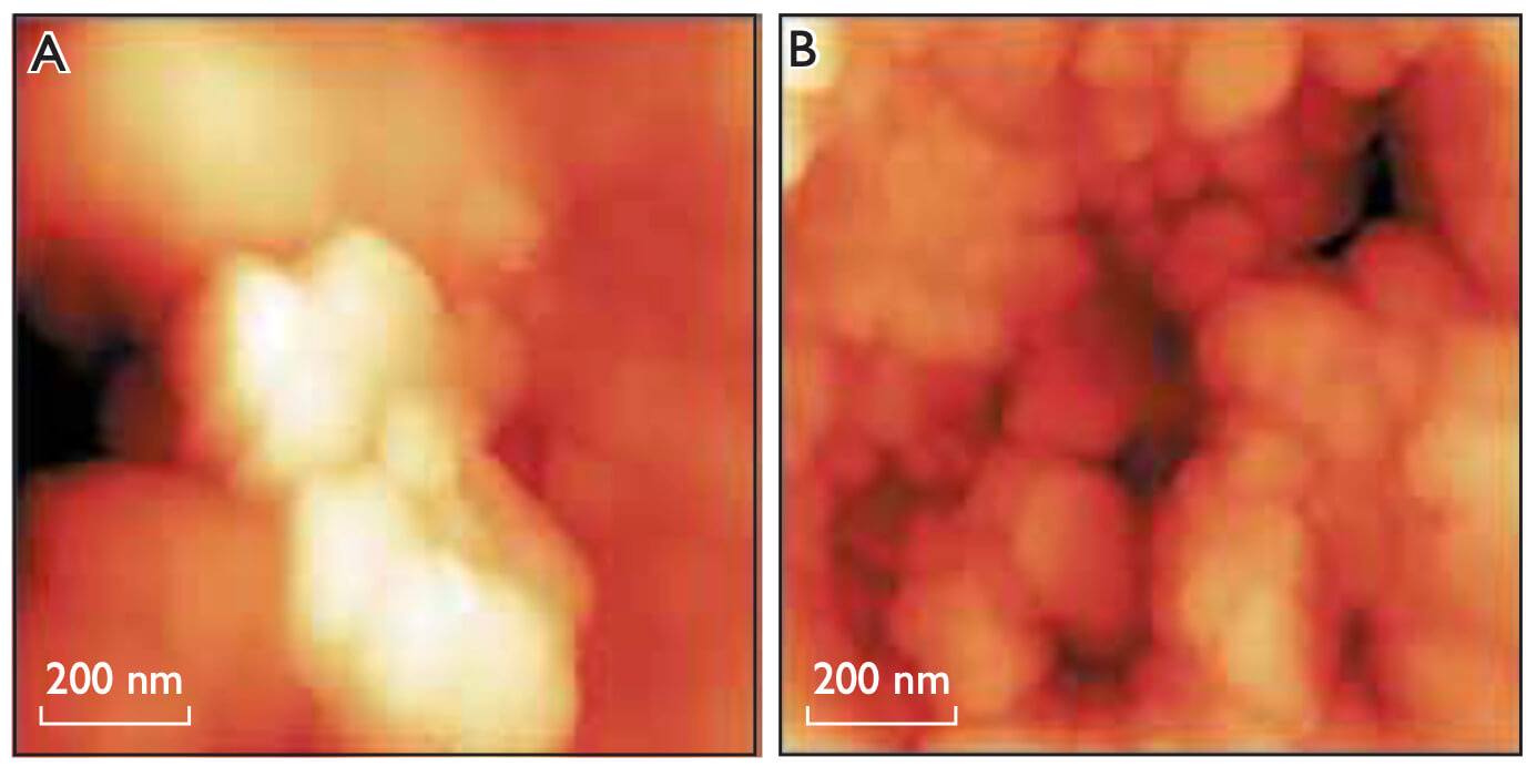 Two microscope images.