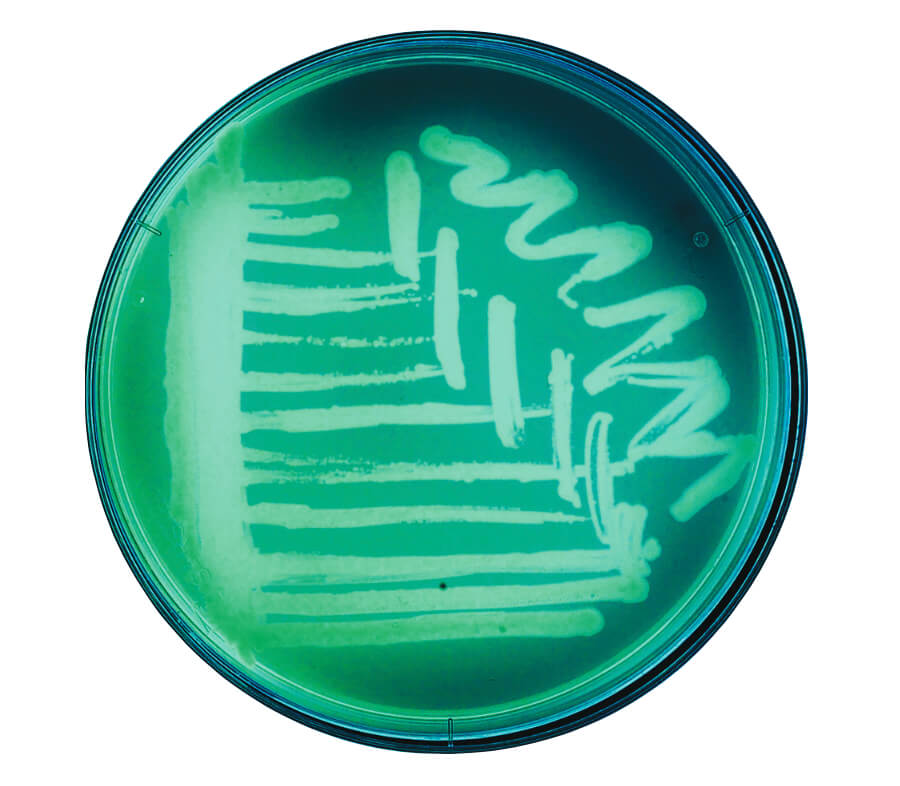 A petri dish.