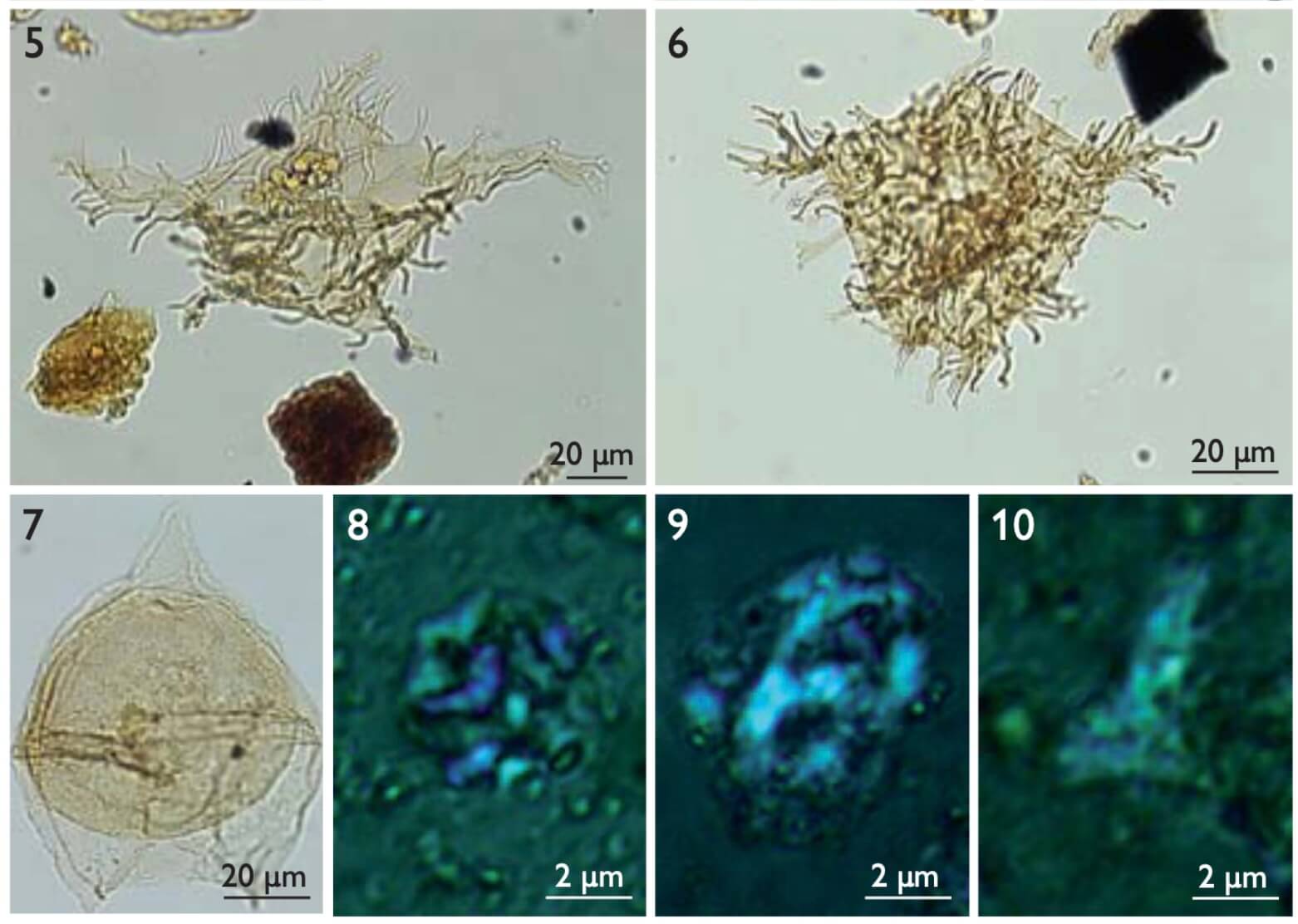 Microfossils viewed under the microscope.