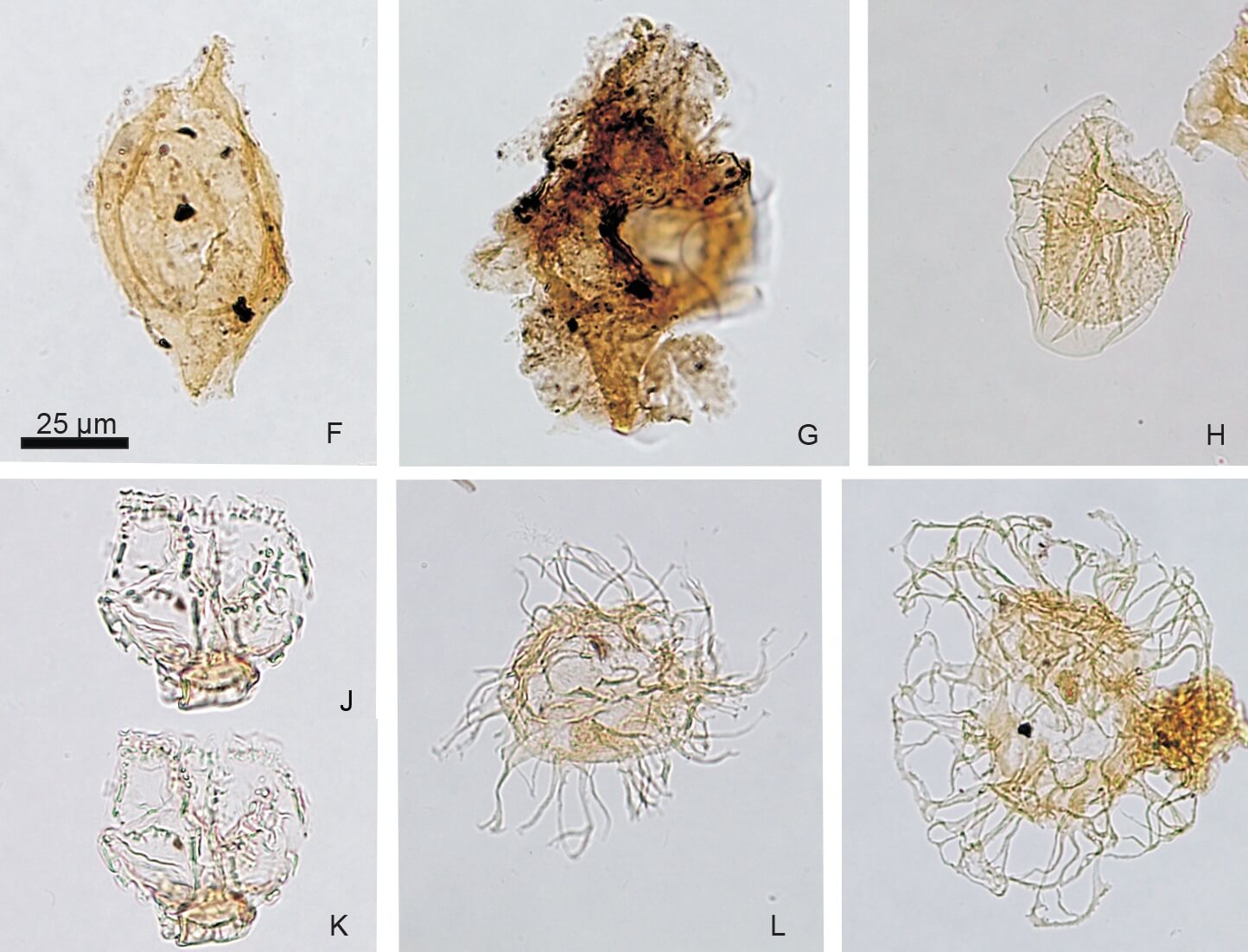 Dinoflagellate cysts under the microscope.